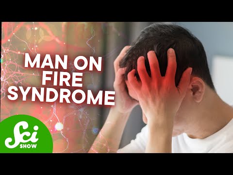 We Don’t Know What Causes the World’s Worst Pain [Video]