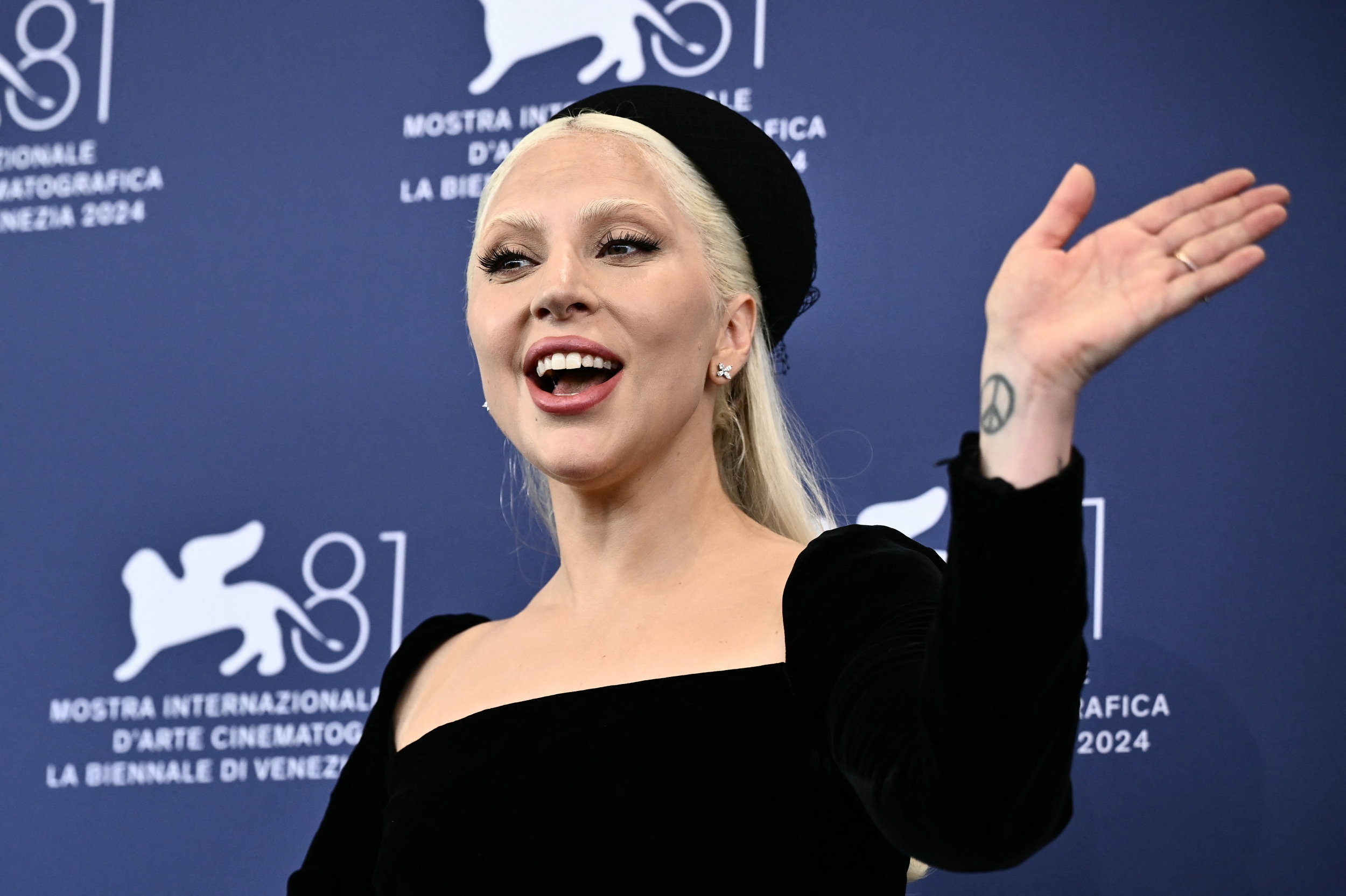 Lady Gaga’s ‘Disease’ Takes Social Media By Storm As Fans Crown It ‘Song of the Year’ [Video]