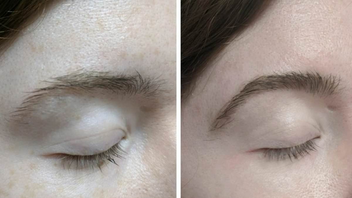 Hack using over-the-counter remedy to help regrow patchy eyebrows really works, doctors claim [Video]