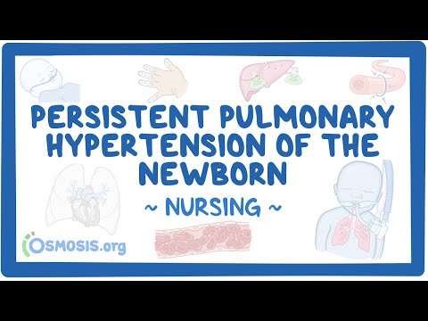 Persistent pulmonary hypertension of the newborn (PPHN): Clinical Nursing Care [Video]