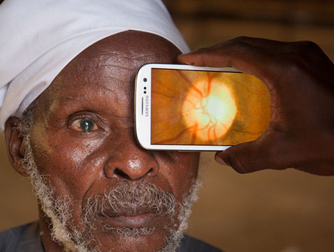 Smartphone App to Detect Blindness in Kenya [Video]