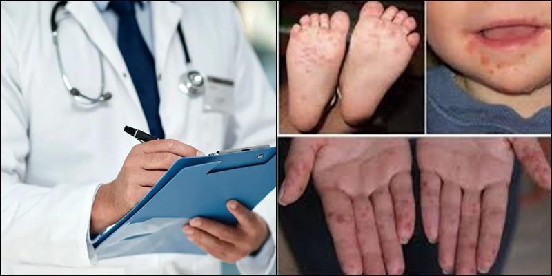 Global prevalence of atopic dermatitis to reach 42.42 mn by 2033: Report [Video]