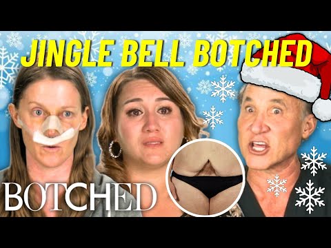 Jingle Bell Botched: Unbelievable Holiday Miracle Transformations | Botched | E! [Video]