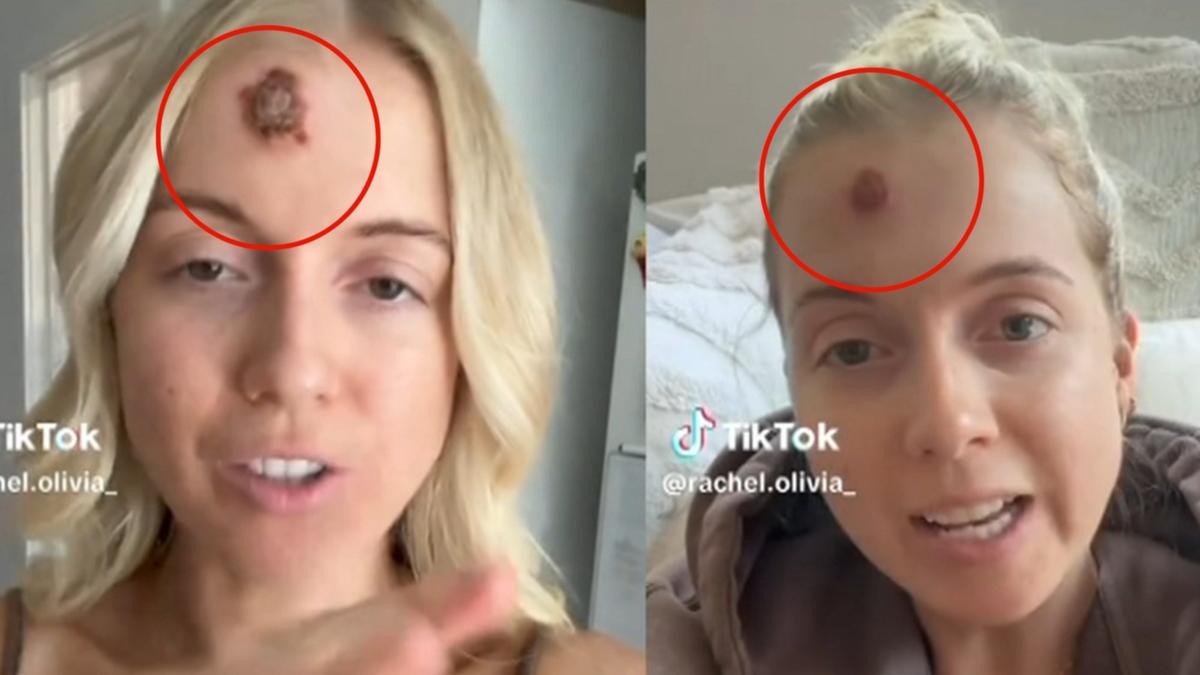 Young mother Rachel Blease shares stark warning about new TikTok trend sweeping up teenage girls [Video]